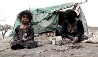 Yemen’de 3 milyon kişi açlıkla karşı karşıya