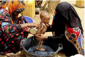 BM: Yemen’de 2 milyon 300  bin çocuk açlıkla karşı karşıya