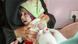 الأمم المتحدة:سوء التغذية الحاد يهدد نصف الأطفال دون سن الخامسة في اليمن