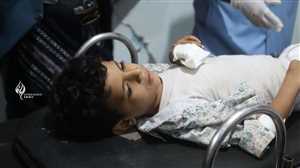 إصابة خطيرة لطفل في تعز جراء قصف شنته مليشيات الحوثي الانقلابية