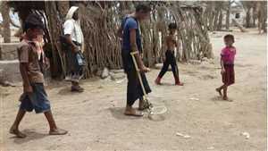 BM: Hudeyde