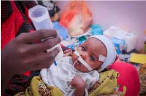 UNICEF’ten G7 ülkelerine Yemenli 2.2 milyon çocuğu yetersiz beslenmeden kurtarmak için ek fon çağrısı