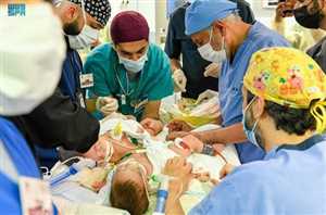 Yemenli yapışık siyam ikizlerini ayırma ameliyatı Suudi Arabistan’da başladı