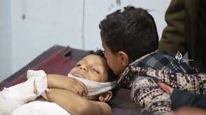 منظمة دولية: مقتل وإصابة 38 طفلاً يمنيا خلال أسبوع