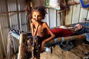 Birleşmiş Milletler: Yemen dahil birçok ülkede açlık oranları on kat arttı