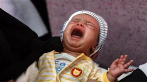 الصحة العالمة: 46% من أطفال اليمن يعانون من التقزّم المُزمن