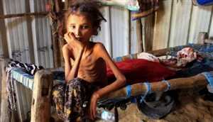 ABD ajansı: Yemen’de açlığı önlemek için ateşkesin uzatılması gerekiyor