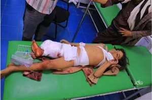 Taiz kentinde Husi saldırısında bir sivilin öldü, 5 çocuk yaralandı