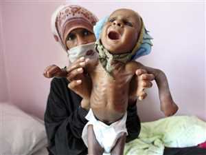 مسؤولة أممية: الجوع لا يزال يطارد أكثر من نصف السكان في اليمن