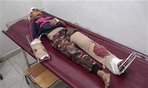 إصابة طفلين بشظايا قذيفة حوثية شرق مدينة تعز
