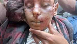 مقتل طفل برصاص قناص في محافظة ذمار