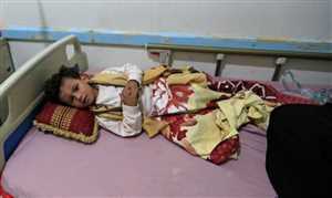 Kızamık Yemenli çocukları öldürüyor