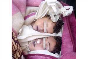 وفاة طفلين شقيقين غرقاً في محافظة تعز