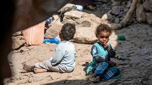 الأمم المتحدة: أكثر من 9 آلاف طفل يمني أصيبوا بالحصبة منذ بداية العام