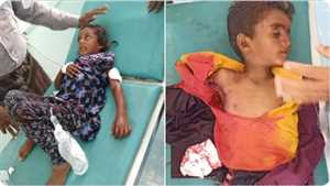 استشهاد طفل وإصابة شقيقته بقصف حوثي جنوب الحديدة