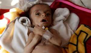 صندوق مواجهة الطوارئ يعلن تخصيص 18 مليون دولار لمنع المجاعة في اليمن