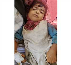 وفاة طفلة بخطأ طبي في محافظة حجة