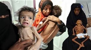 الإنذار المبكر: اكثر من نصف سكان اليمني مهددون بالمجاعة العام القادم