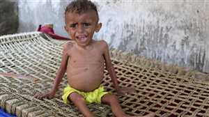 BM: Yemenlilerin yarısı gıda güvensizliğinden muzdarip