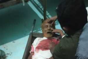 مقتل مدني برصاص عناصر من قوات العمالقة جنوبي الحديدة