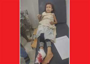 إصابة طفلة وامرأة واحتراق منازل بنيران مليشيات الحوثي بتعز