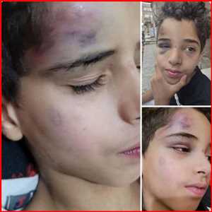 ركلاً بالأقدام.. عنصران حوثيان يعتديان بوحشية على طفل في وسط صنعاء