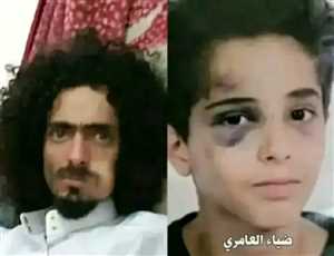اعتقال المعتدين على طفل القادسية في صنعاء بعد موجة غضب شعبي