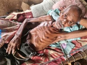 بعد رصد حالة وفاة.. الجوع يضرب مخيمات النازحين في محافظة حجة وينذر بكارثة وشيكة