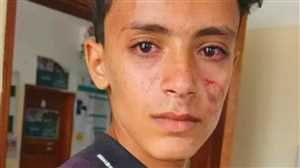 اعتداء مروع في ريمة: مشرف حوثي يضرب طفلًا ووالدته ويسبب موجة غضب بين الأهالي