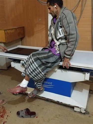 أثناء تأديتهم صلاة الجمعة.. قذائف الحوثيين تصيب 6 مدنيين في ساحة الحرية بتعز