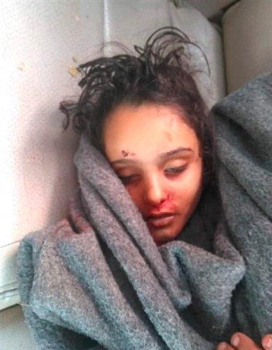 الطفلة نوران.. ضحية جديدة للسلاح المنفلت في مدينة تعز