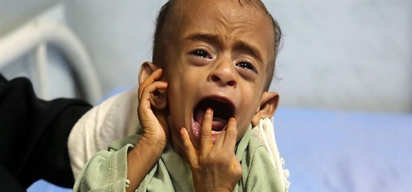 منظمة رايتس رادار: جحيم يواجهه أطفال اليمن والحوثيون المتسبب الأول