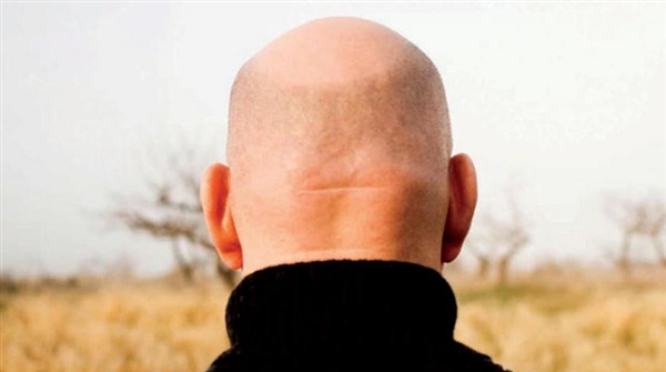 دراسة: تلوث الهواء سبباً لتساقط الشعر