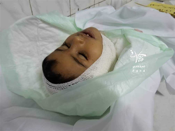 استشهاد  طفل بقذيفة حوثية في تعز