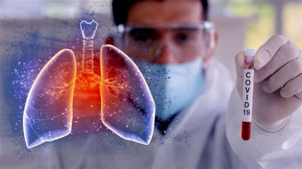 آخر أرقام إصابات ووفيات فيروس كورونا حول العالم اليوم الاثنين