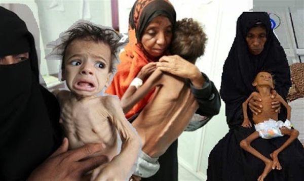 تحذير أممي من مجاعة تستهدف ملايين الأطفال اليمنيين