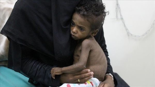 الأمم المتحد:10 ملايين يمني على بعد خطوة من المجاعة