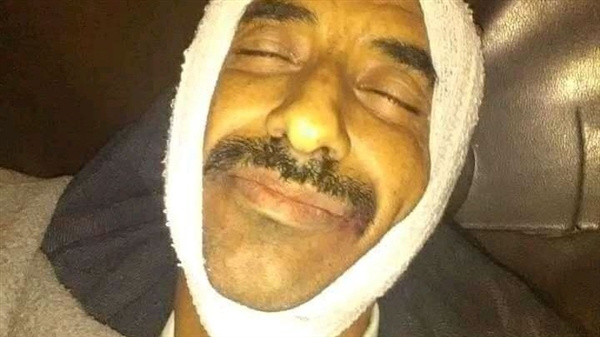 اغتيال قائد مقاومة قعطبة وإصابة نجله وشقيقه بكمين مسلح في الضالع