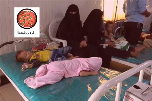 Dünya'da kızamık vakaları yüzde 300 arttı