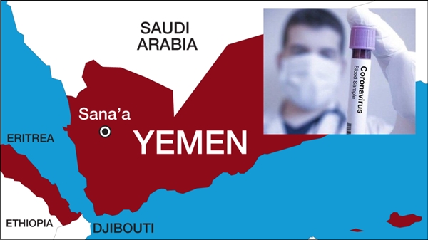Yemen'de ilk korona virüs vakası