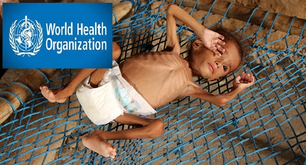 DSÖ: Yemen’de 15 bin çocuk tedavi edildi