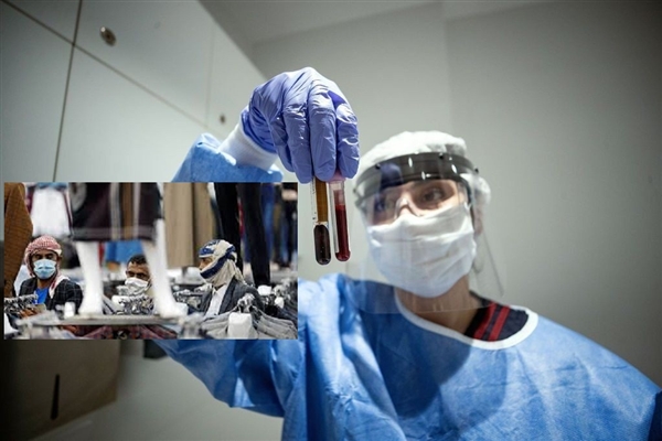 Yemen’de koronadan ölenlerin sayısı 500’ü buldu