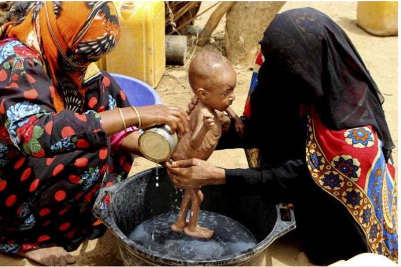 BM: Yemen’de 2 milyon 300  bin çocuk açlıkla karşı karşıya