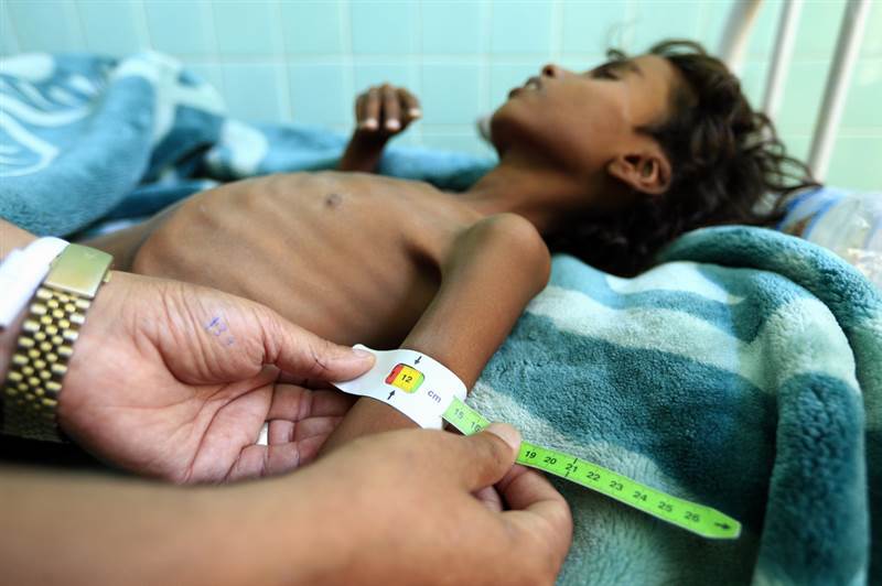 BM’den Yemen ile ilgili ürküten rapor