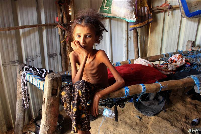 DSÖ: Yemen'deki çocukların yarısı akut yetersiz beslenme riski altında