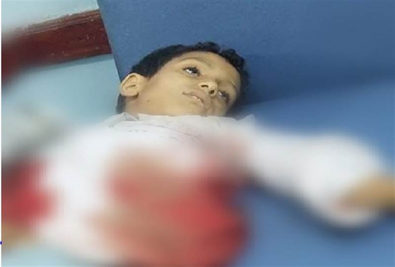 بينهم 70 طفلا و41 امرأة.. الأمم المتحدة: 529 مدنيا باليمن بين قتيل وجريح خلال 3 أشهر
