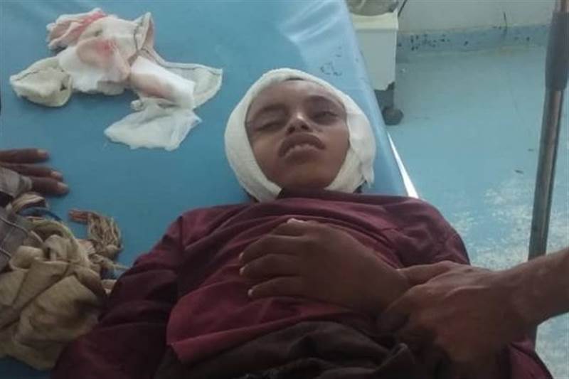 قناص حوثي يصيب طفل في رأسه جنوب الحديدة