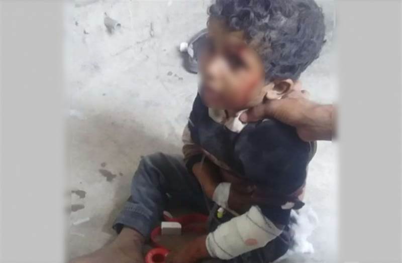إصابة طفل بانفجار مقذوف حوثي في محافظة لحج