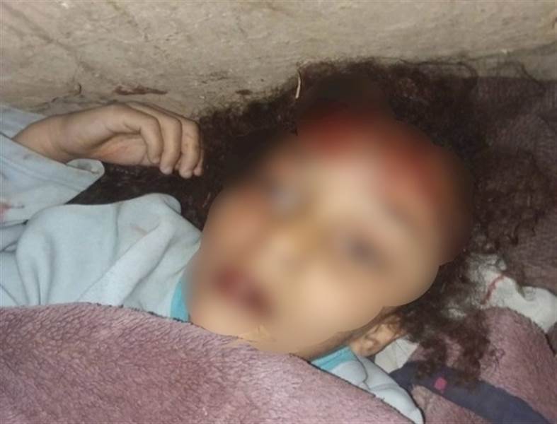 في جريمة جديدة.. أب يضرب طفلته الصغيرة حتى الموت في محافظة إب