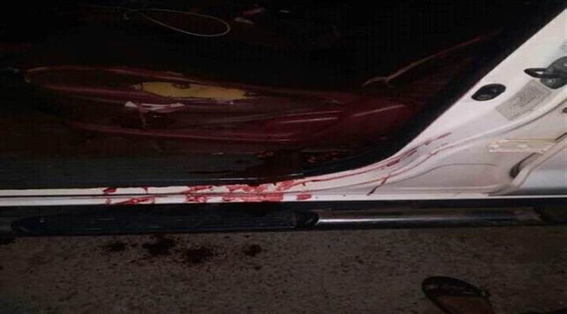 إصابة خطيرة لقائد حراسة بسام المحضار في العاصمة المؤقتة عدن